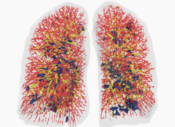 The Rapid Increase of Cutting-Edge Digital Devices for Respiratory Care
